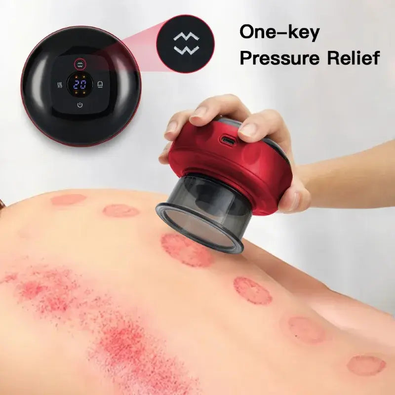 RelaxRange™ Vacuum Cupping therapy